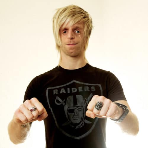 Bilde av Jono Lancaster som har Treacher Collins Syndrom.